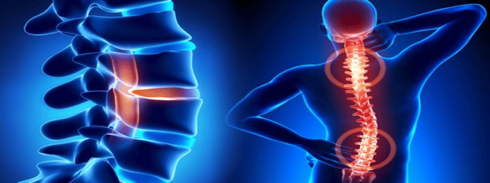 Illustration of the cervical spine beside a figure holding their neck and lower back