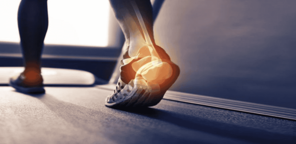 A foot on a treadmill with the bones of the ankle and heel highlighted in orange