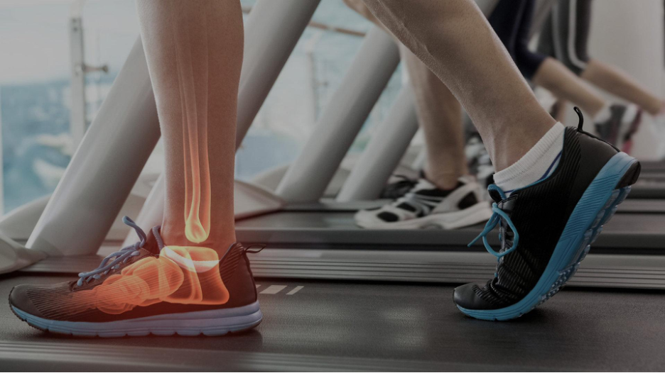 Runners on treadmills with an illustrated overlay highlighting the bones of the foot and ankle.