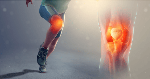 Runner's legs with the knee joint illustrated and highlighted in orange